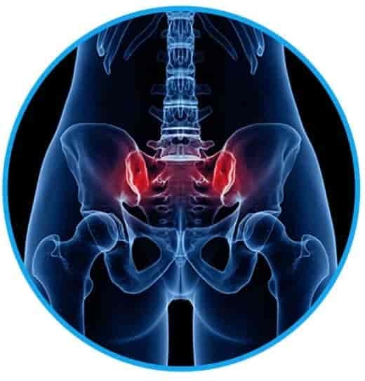 Pelvic pain