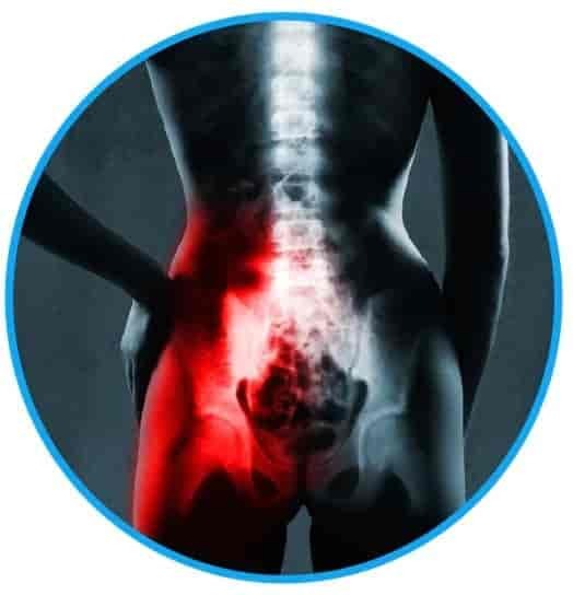 Joint dysfunction