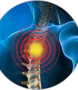 Pinched Nerve Relief